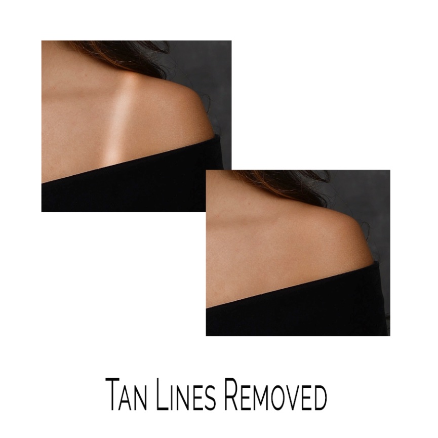 Tan Lines Removed (1 Photo)